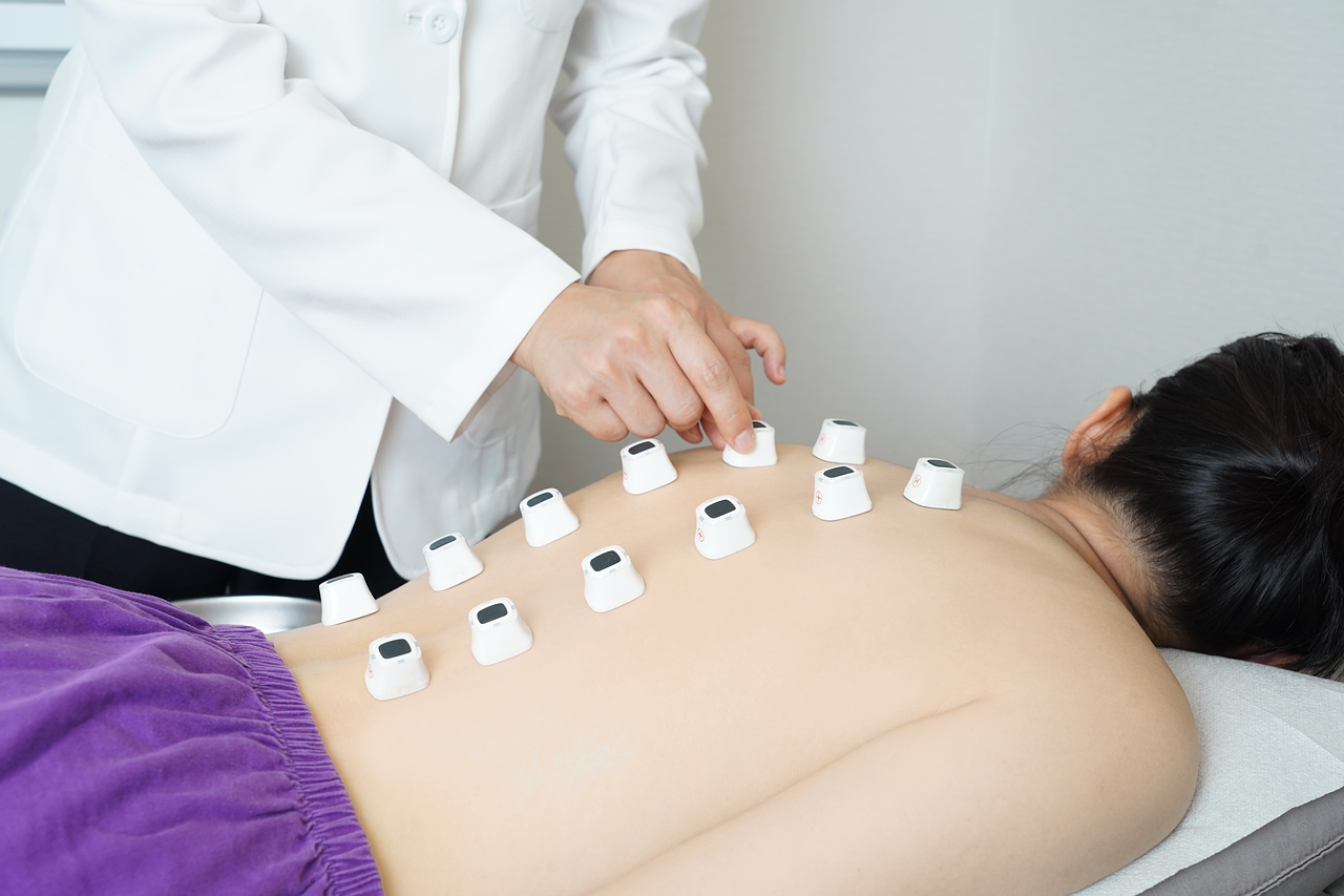 Acupuncture and Moxibustion
