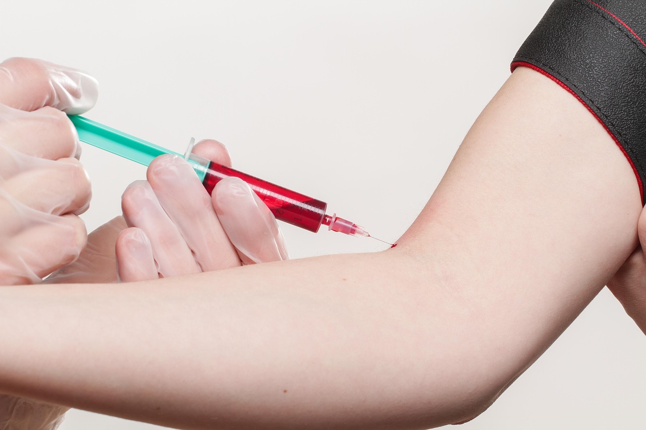 Nutrition Therapy for Diabetes