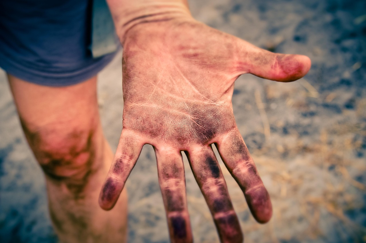 Psychosocial Aspects Of Skin Conditions