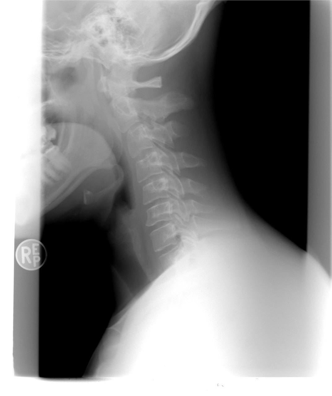 AI Applications in Radiology