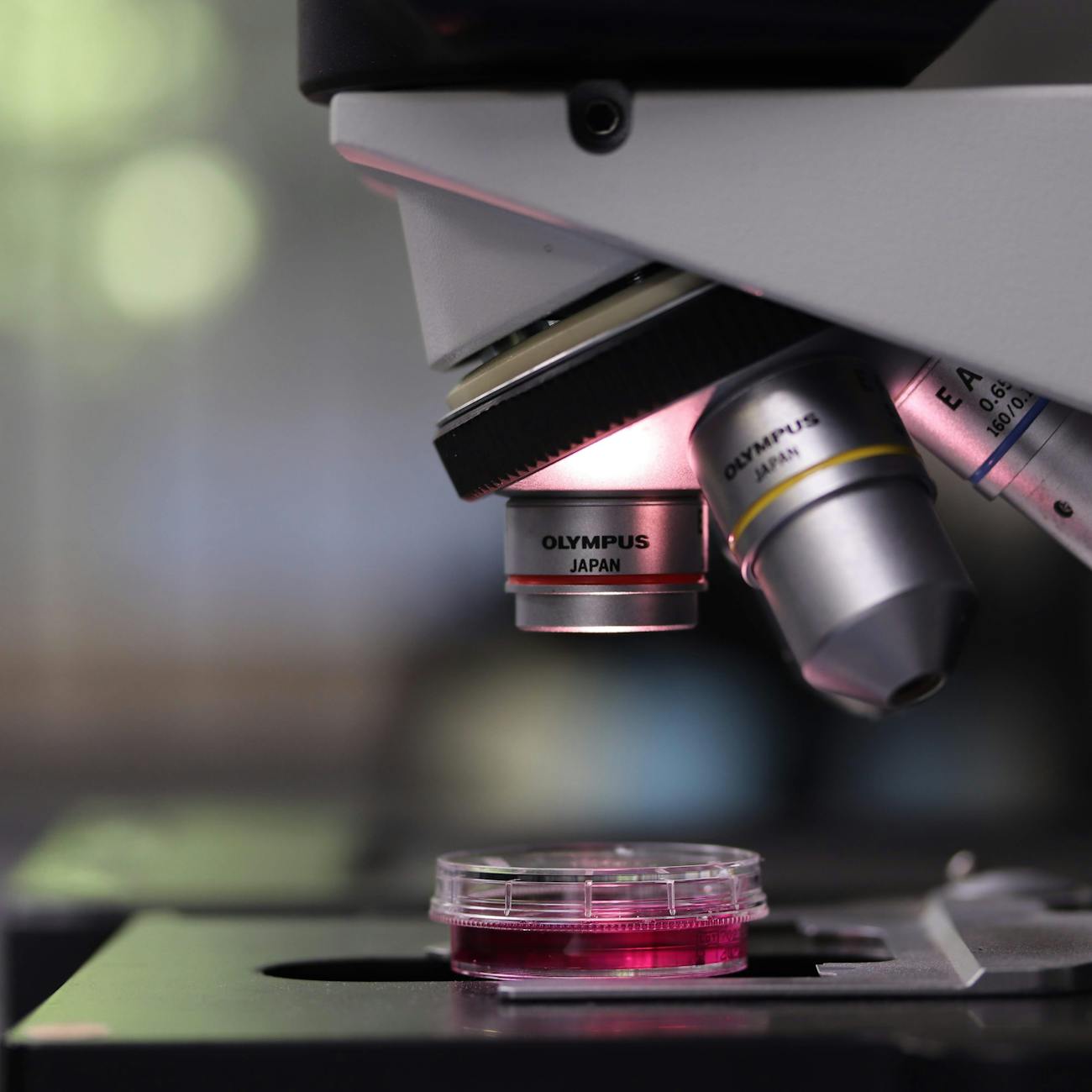 Clinical Trials and Research in NMOSD Treatment