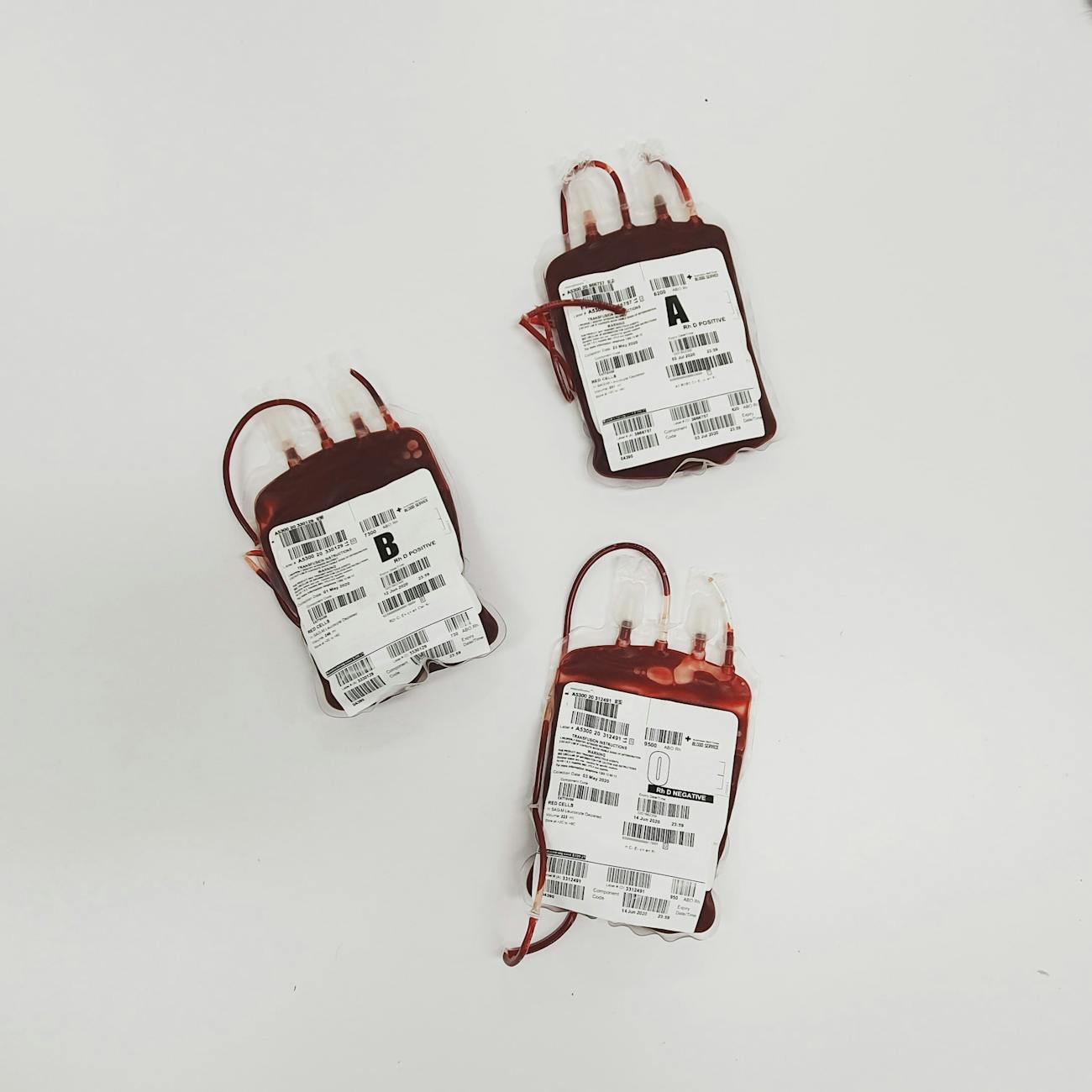 Advanced Heart Failure Diagnostic Testing